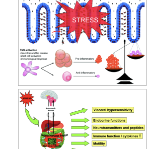 stress and IBS